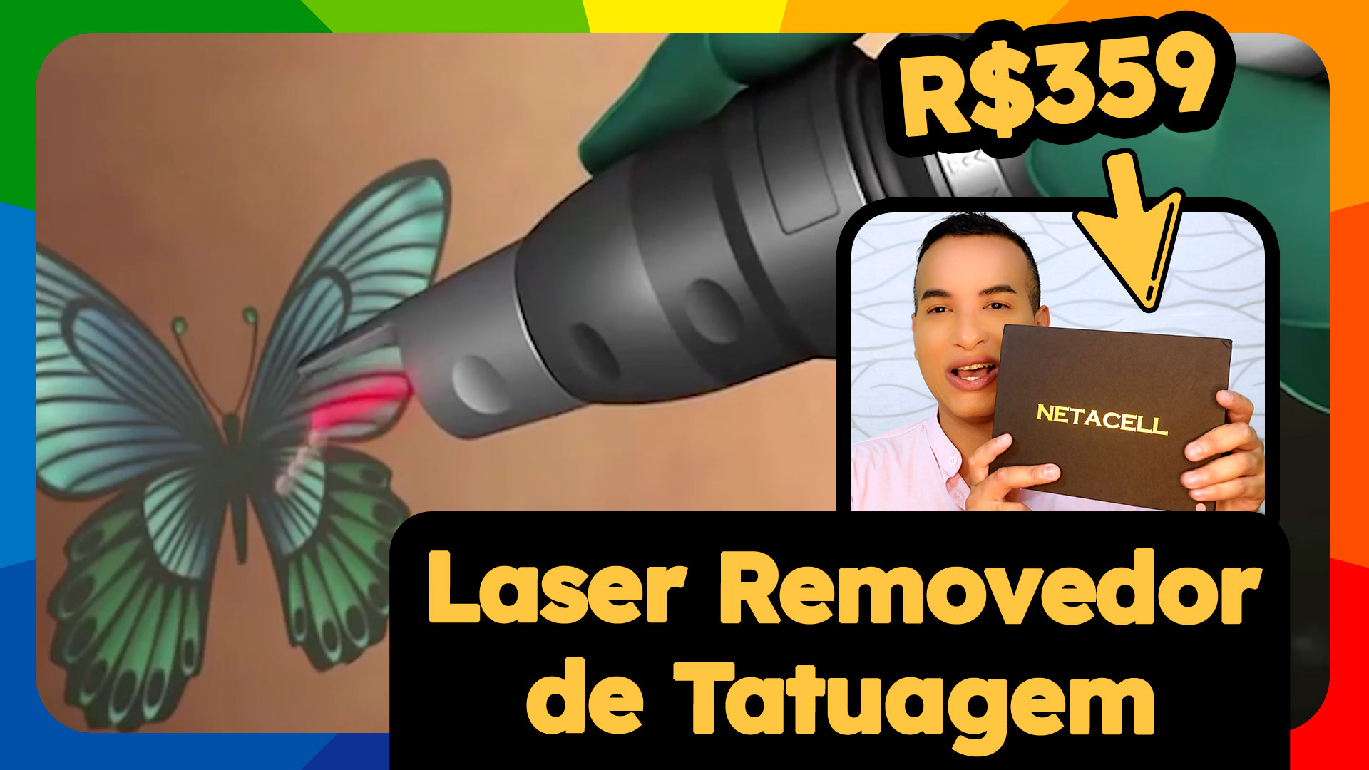Laser removedor de tatuagem